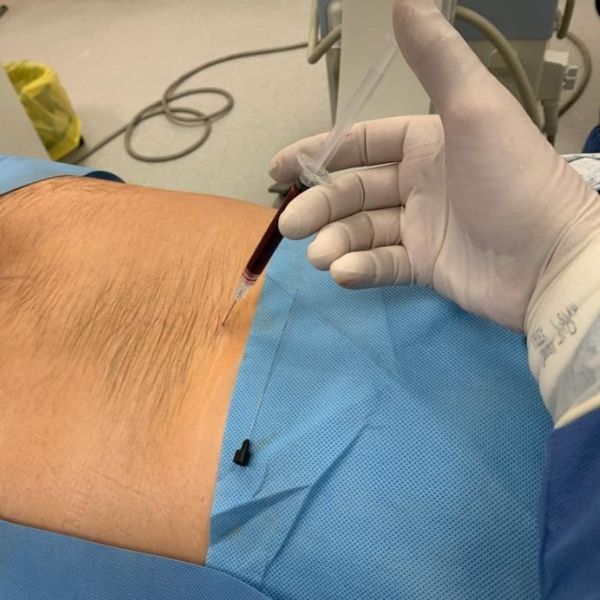 Alivio del dolor de ciática en Tijuana