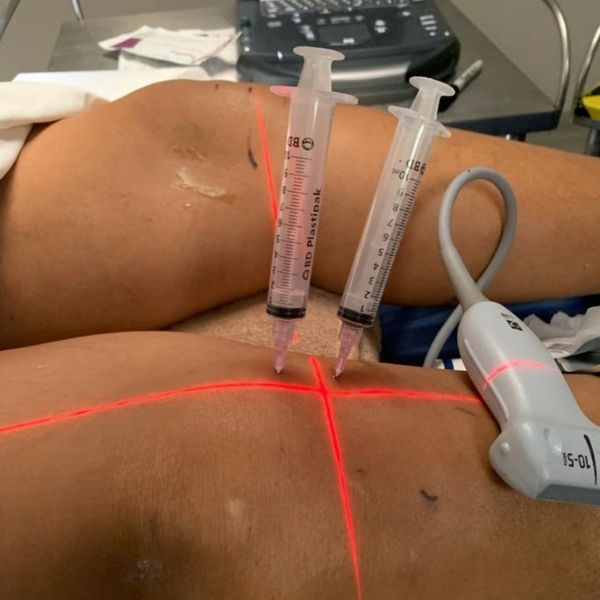 Dolor de Rodilla